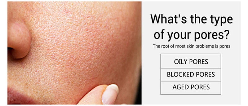 Salicylic Acid Skin tightening Cream