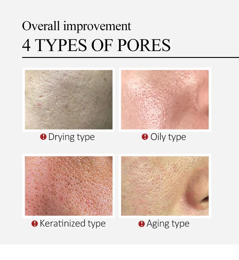 Salicylic Acid Skin tightening Cream