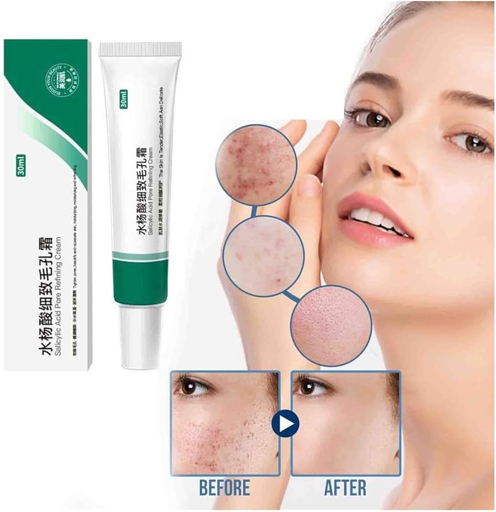 Salicylic Acid Skin tightening Cream