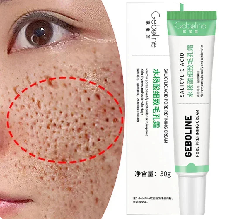Salicylic Acid Skin tightening Cream
