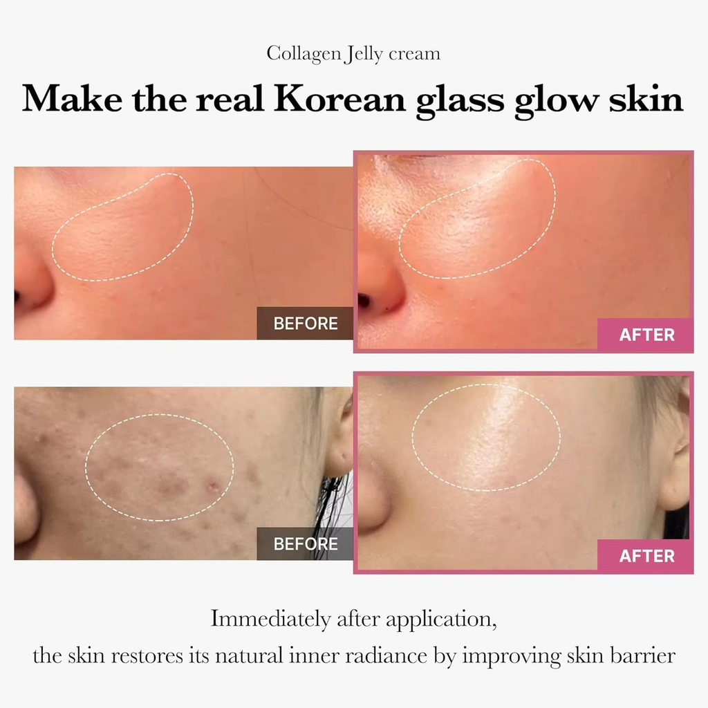 Medicube Collagen Jelly Cream Niacinamide Strengthens Skin's Barrier Moisturizes and Glows