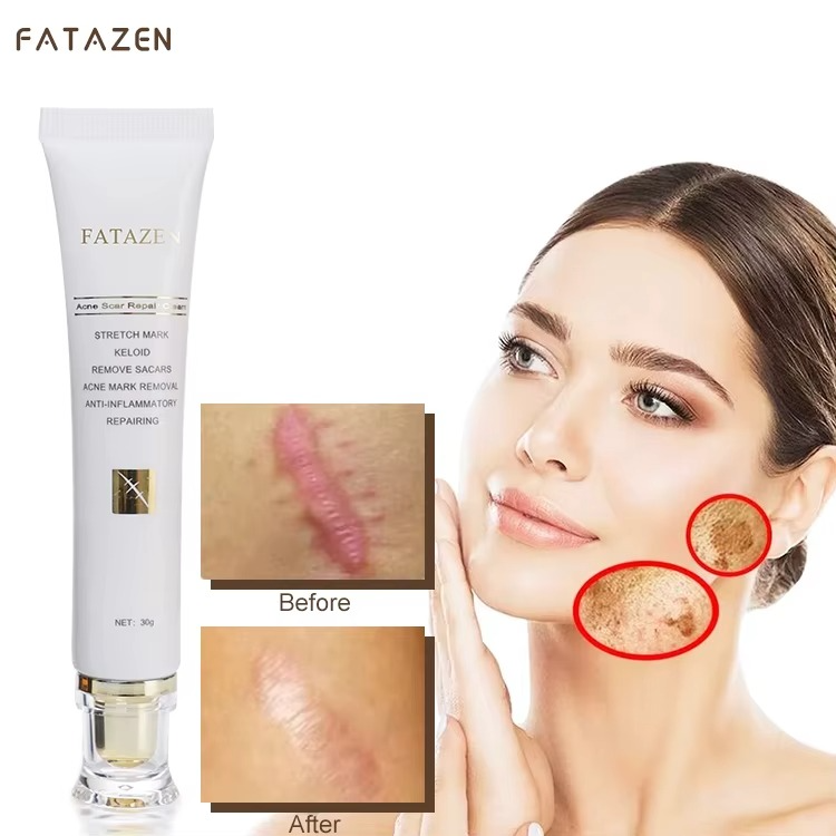 FATAZEN Scar removal Cream