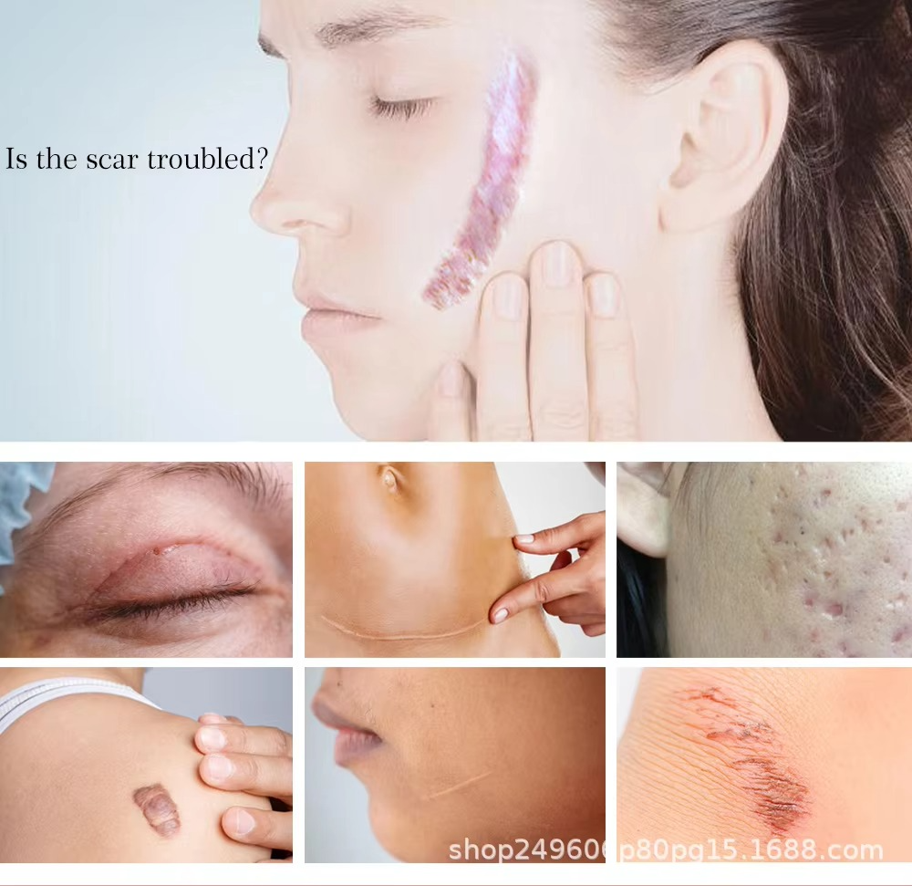 Yoxier Lavender Scar Repair Cream