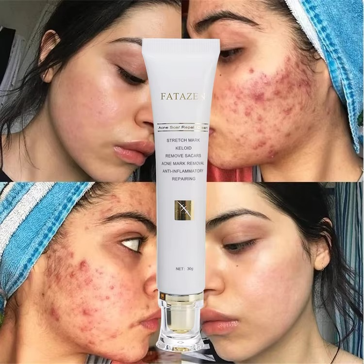 FATAZEN Scar removal Cream