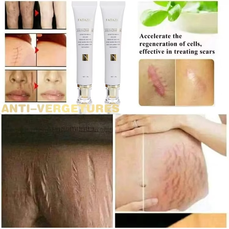 FATAZEN Scar removal Cream