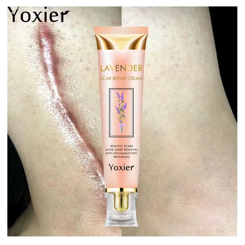 Yoxier Lavender Scar Repair Cream