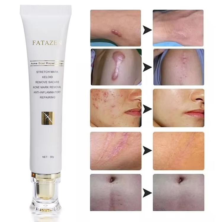 FATAZEN Scar removal Cream