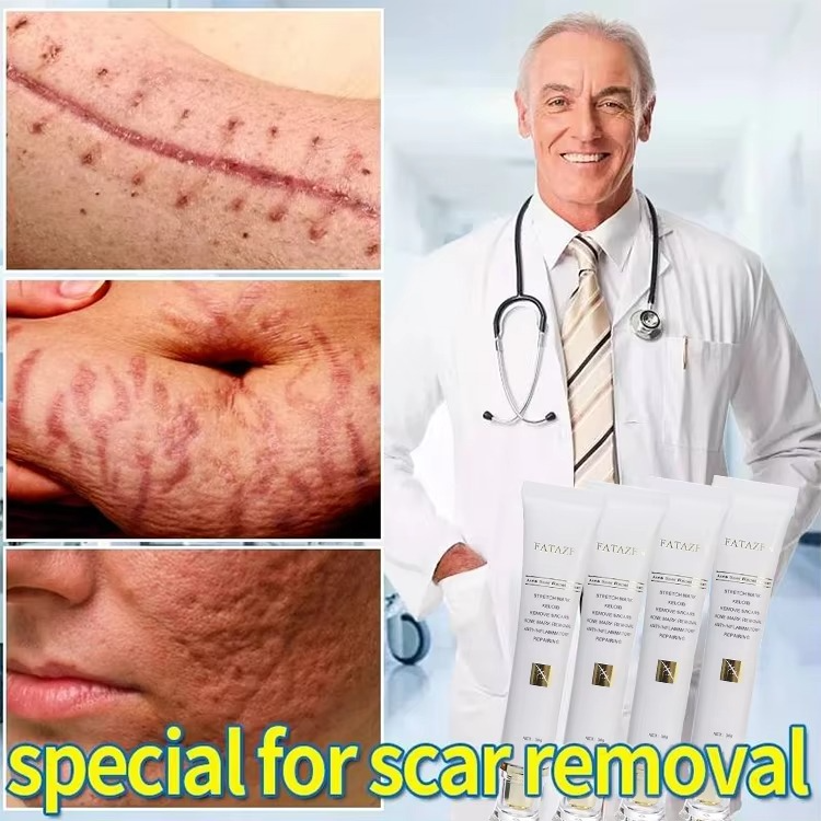 FATAZEN Scar removal Cream