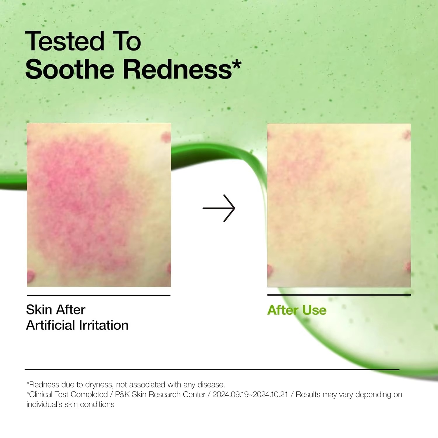 Anua Azelaic  Korean Skincare serum for Sensitive Skin