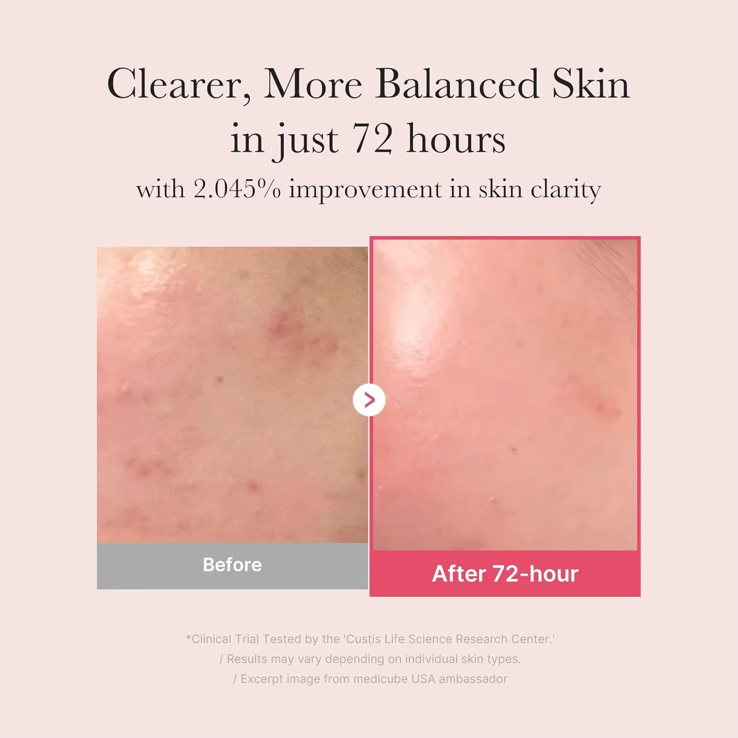 Medicube TXA+Niacinamide 15% Facial Serum for Post Spot Treatment | All-in-One Daily Korean Skincare