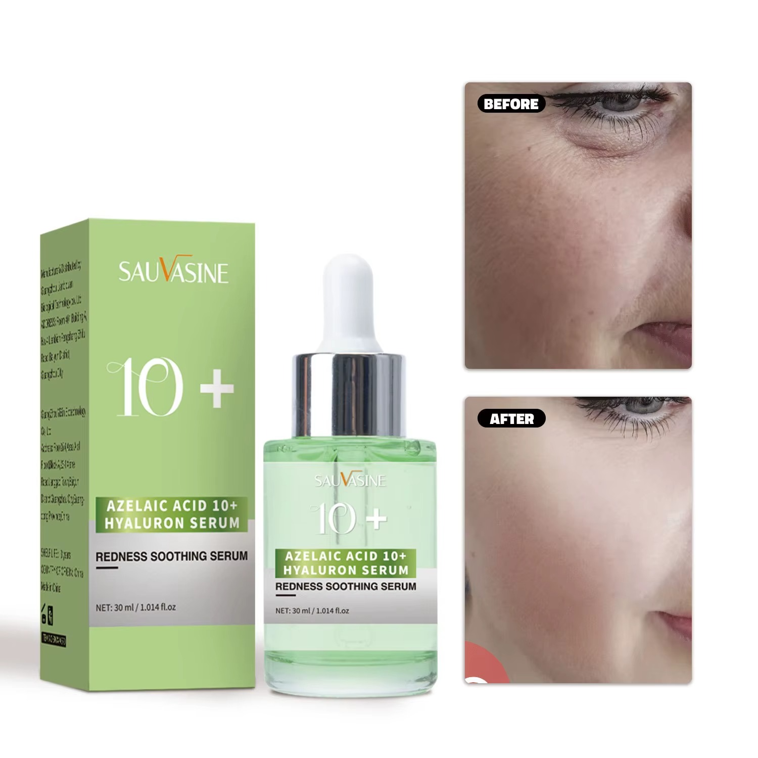 Sauvasine Azelaic Acid 10+hyaluronic Acid Serum