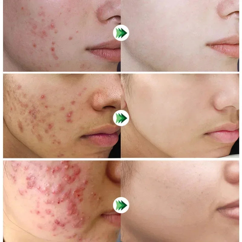 Korean Salicylic Pore Repair