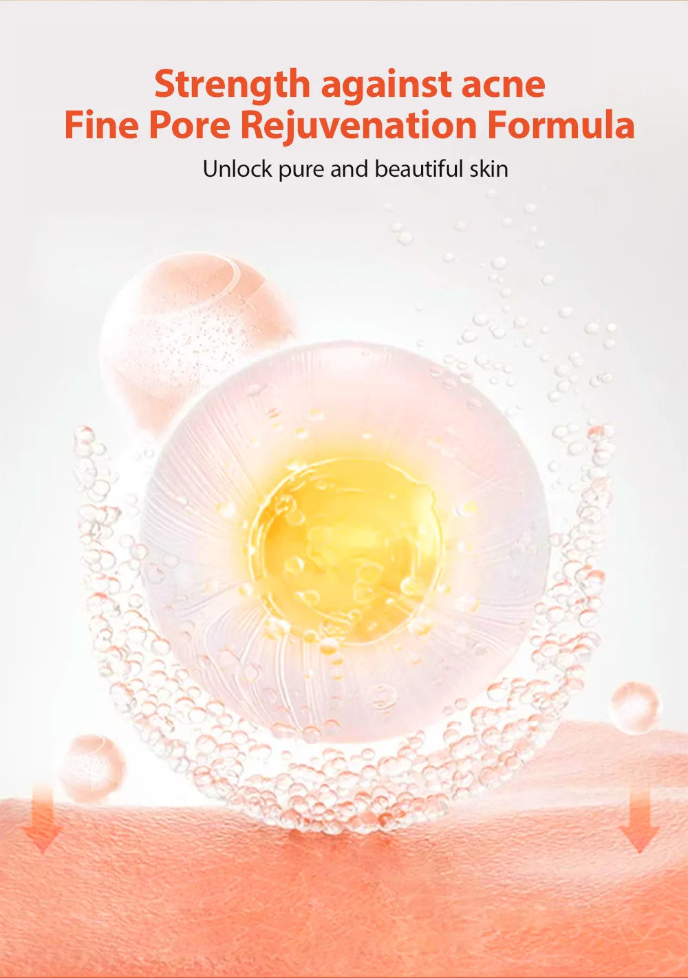 Herbal Acne Gel