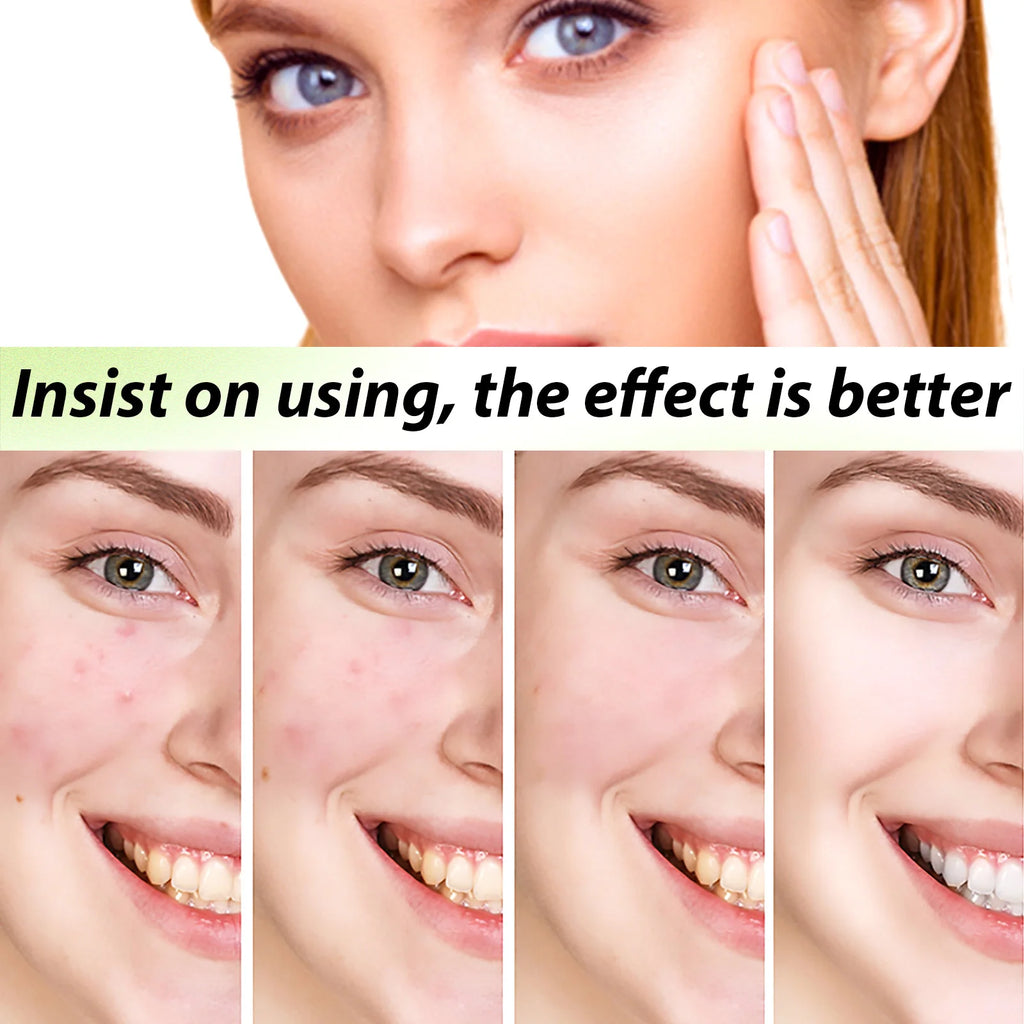 Herbal hydrating serum & blackhead remover