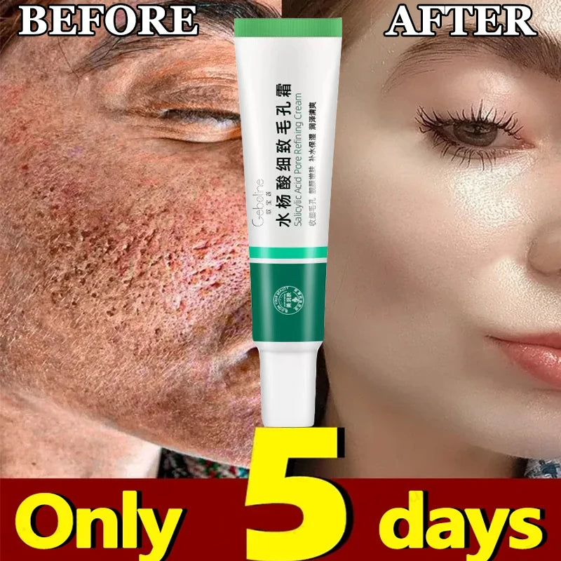 Korean Salicylic Pore Repair