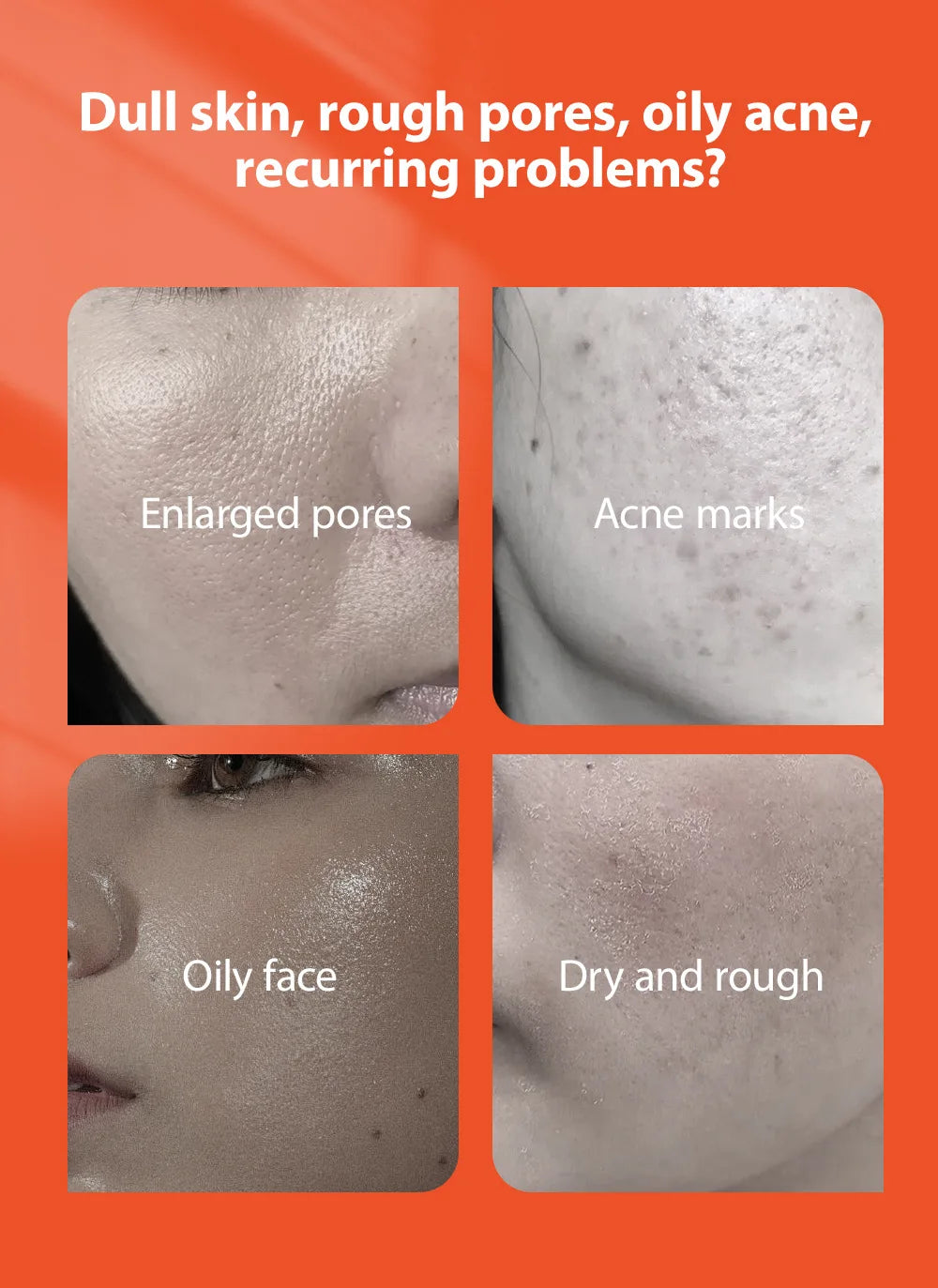 Herbal Acne Gel