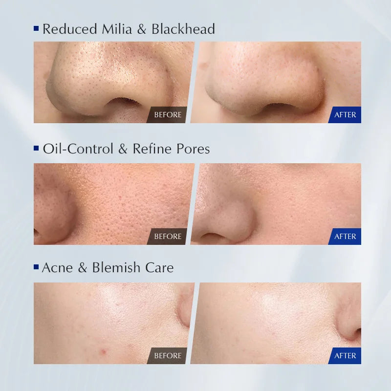 Korean Blue lotus facial cleanser