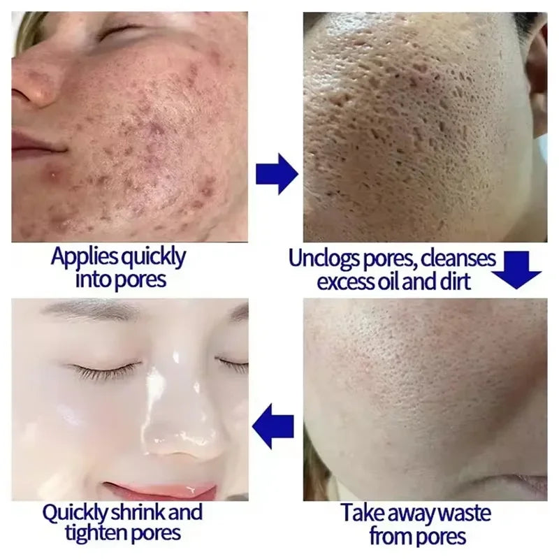 Korean Salicylic Pore Repair