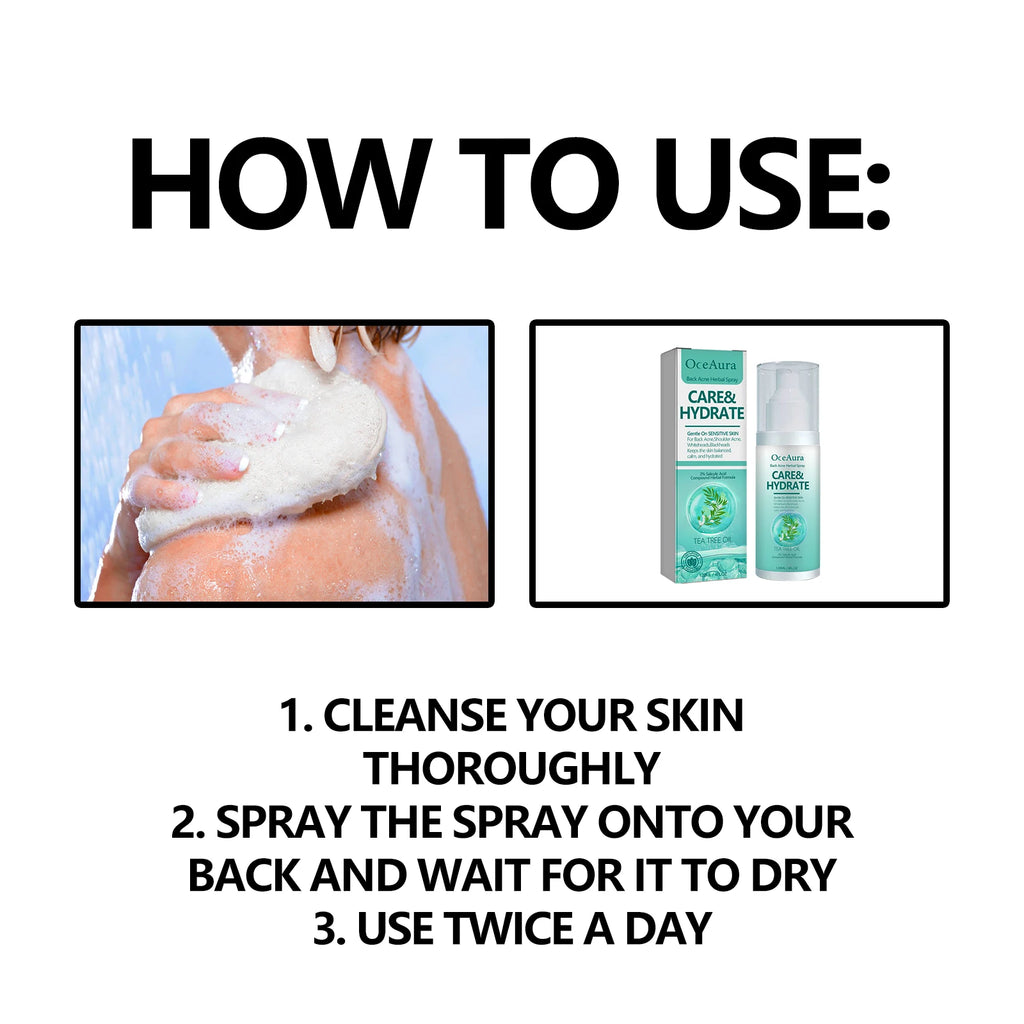 Herbal Acne back spray