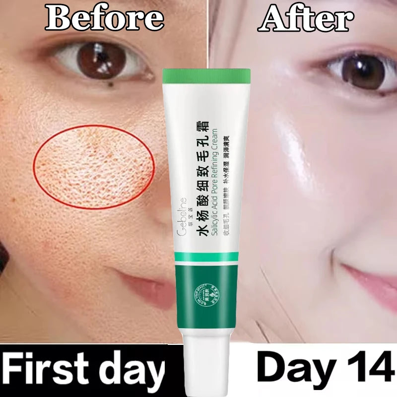 Korean Salicylic Pore Repair