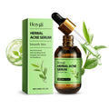Herbal hydrating serum & blackhead remover