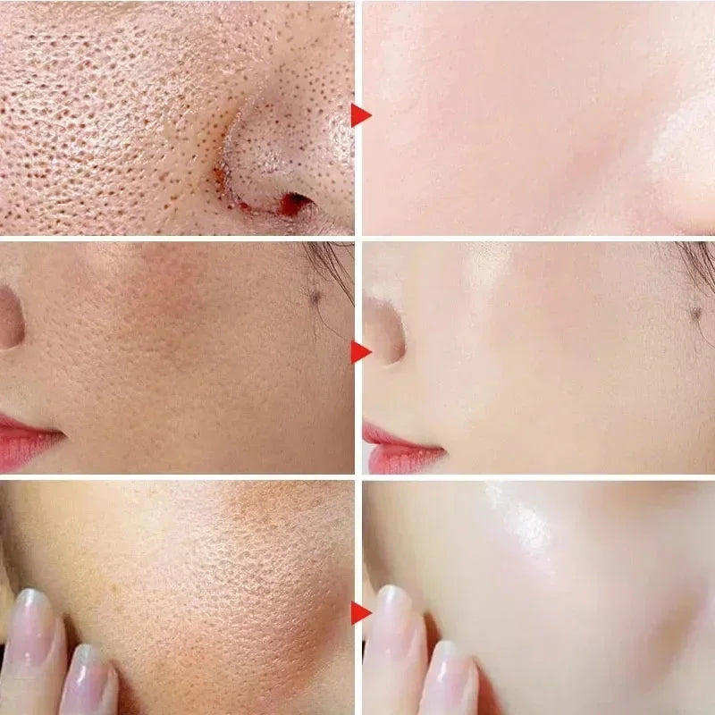 Korean Salicylic Pore Repair