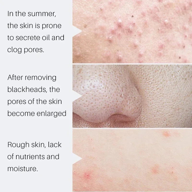 Korean Salicylic Pore Repair