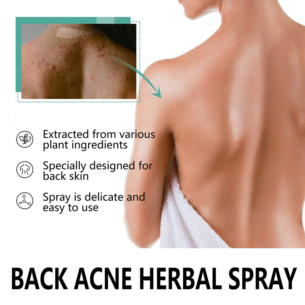Herbal Acne back spray