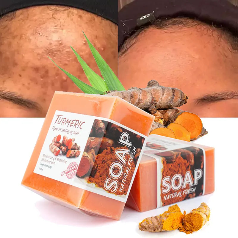 Natural Hand Made Turmeric Turmeric Soap.