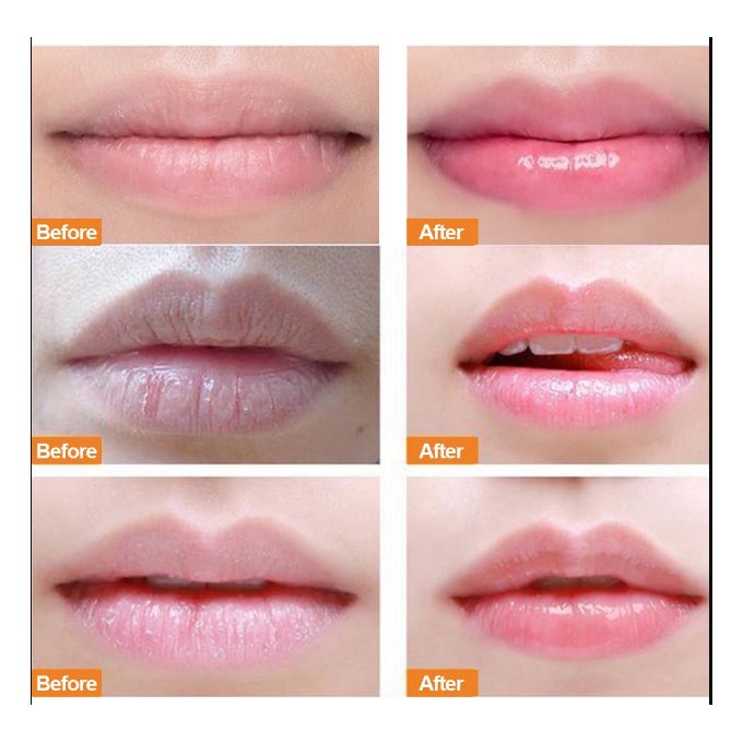 Aliver Double effect lip treatment lip scrub and lip balm
