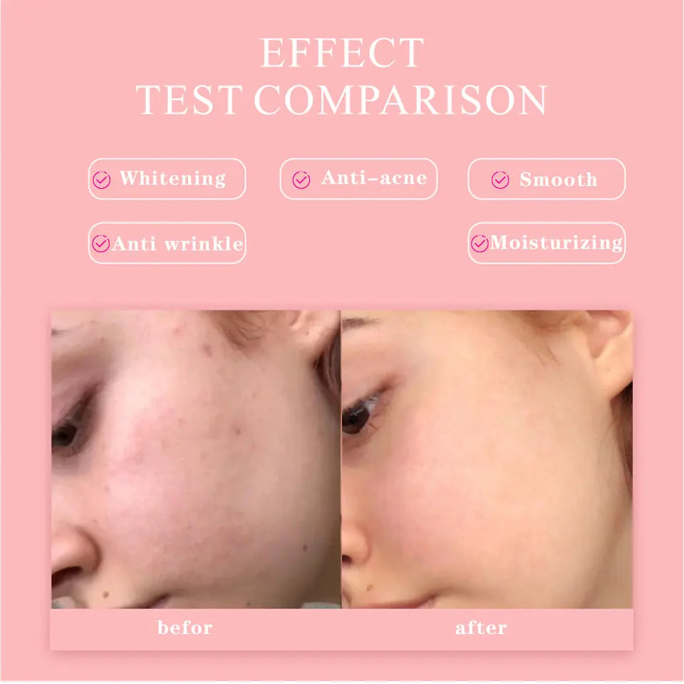 5 in 1 Anti Wrinkle & Anti Aging Face Serum