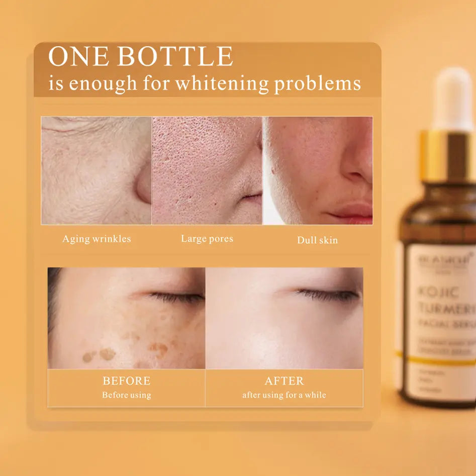 Turmeric Dark Spot Remover